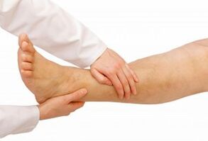 doctor examines a leg with varicose veins